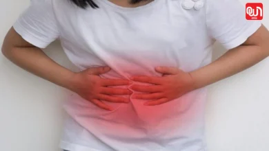 Gallstones in Children