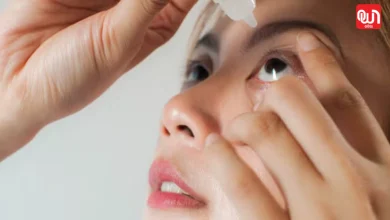 Itchy Eyes Treatment