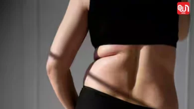 Back Fat Removal Tips