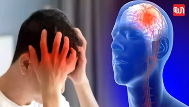 Brain Stroke Prevention