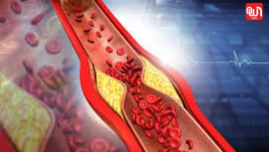 Unblock a blocked vein