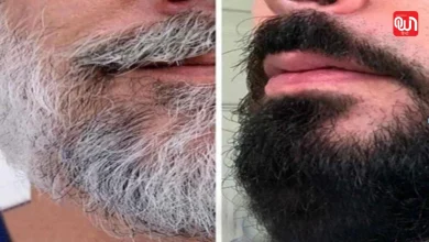 White beard turn black naturally (1)