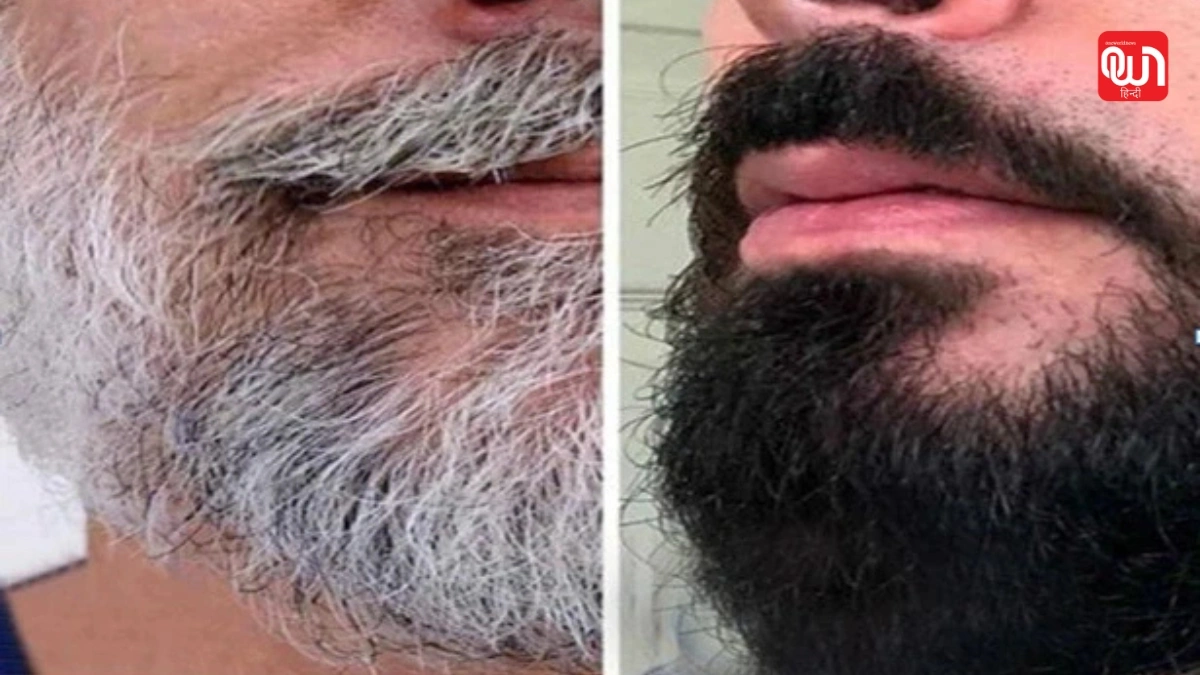 White beard turn black naturally (1)