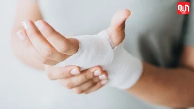 Hand burn treatment