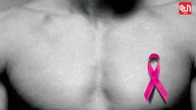 Male Breast Cancer