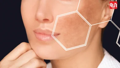 Pigmentation On Face