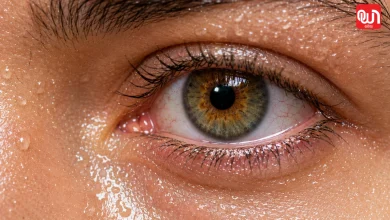 Sweat Eyes